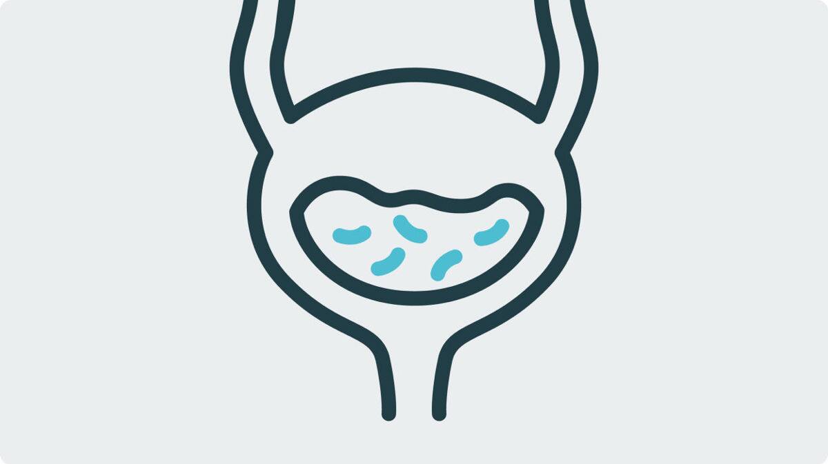 Lower urinary complication risk with IC versus indwelling catheters