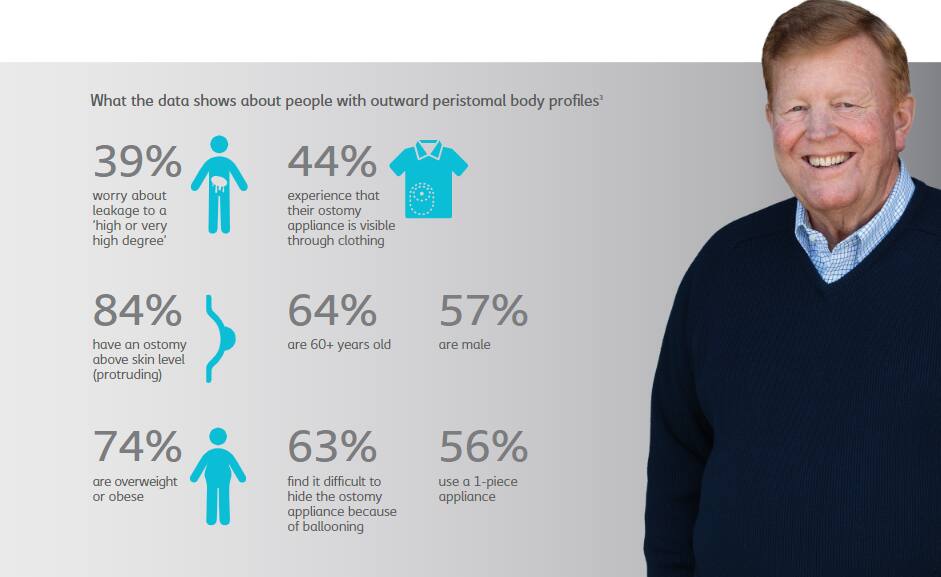 Have the needs of people with outward peristomal body profiles been overlooked?